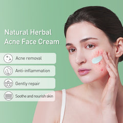 Acne Face Cream Herbal Pimple Scar Removal Shrink Pore