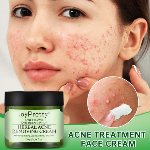 Acne Face Cream Herbal Pimple Scar Removal Shrink Pore