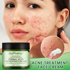 Acne Face Cream Herbal Pimple Scar Removal Shrink Pore